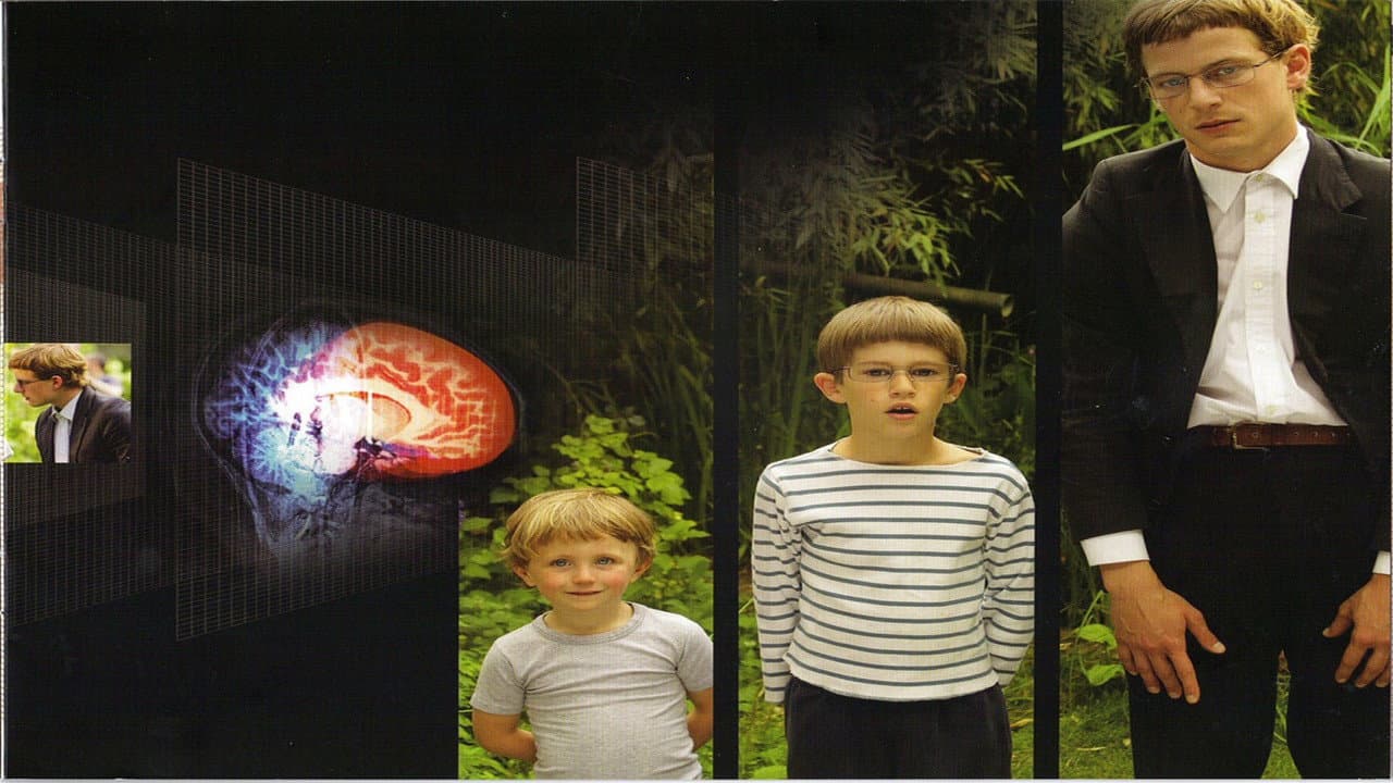 El cerebro de Hugo