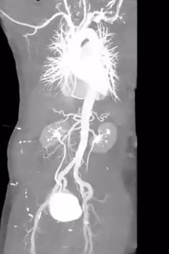 X-Ray Eros